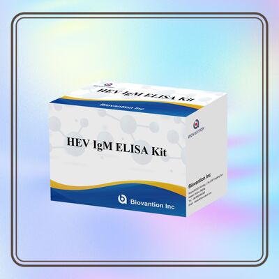 Bộ thử nghiệm Elisa HEV IgM độ nhạy cao với kích thước 96T và thời gian xét nghiệm 2-3 giờ để chẩn đoán chính xác