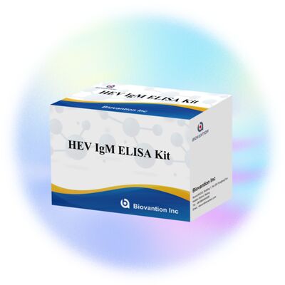 Bộ thử nghiệm Elisa HEV IgM độ nhạy cao với kích thước 96T và thời gian xét nghiệm 2-3 giờ để chẩn đoán chính xác