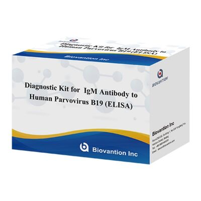 Bộ xét nghiệm ELISA 96T bán trực tiếp từ nhà máy để phát hiện kháng thể IgM Parvovirus B19 ở người với phương pháp đo màu và thời hạn sử dụng 18 tháng