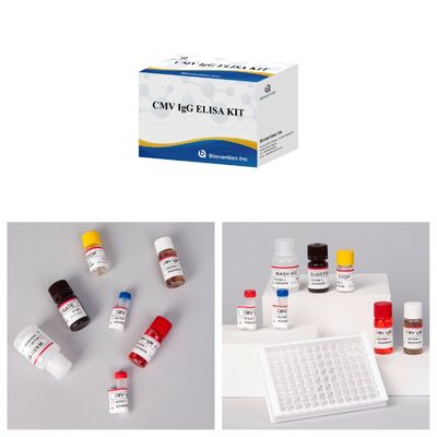 Bộ thử nghiệm 96T CMV ELISA với phát hiện màu và phương pháp sandwich cho kháng thể cytomegalovirus