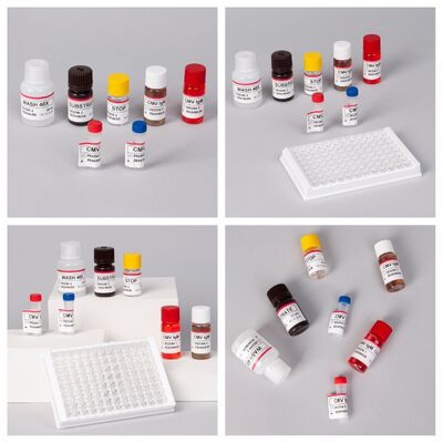 Bộ thử nghiệm 96T CMV ELISA với phát hiện màu và phương pháp sandwich cho kháng thể cytomegalovirus