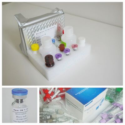 Bộ thử nghiệm TB IGRA Elisa có thể tùy chỉnh với độ cụ thể cao và thời hạn sử dụng 18 tháng để chẩn đoán bệnh lao