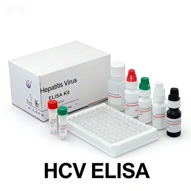 Anti-HCV Elisa Test Kit with High Specificity for 96 Tests and 1.5-3 Hours Assay Time
