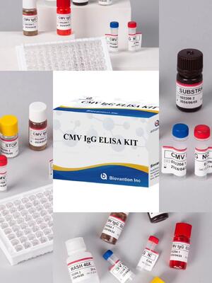 Phòng thí nghiệm hoặc bệnh viện High Accuracy CMV IgG Elisa Test Kit