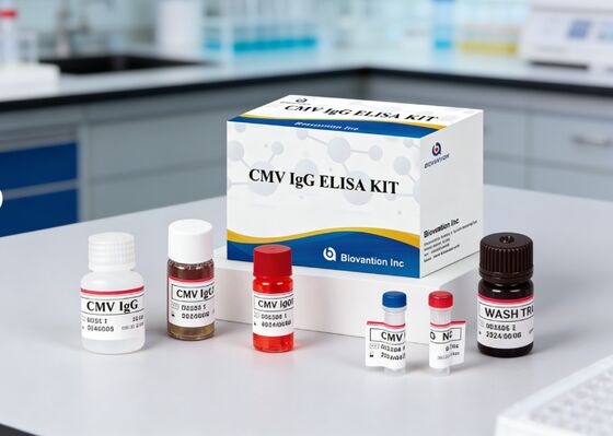 Phòng thí nghiệm hoặc bệnh viện High Accuracy CMV IgG Elisa Test Kit