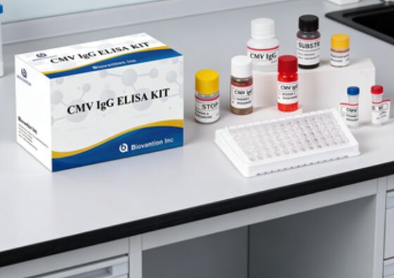 Phòng thí nghiệm hoặc bệnh viện High Accuracy CMV IgG Elisa Test Kit