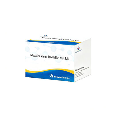 Virus sởi IgM ELISA Test Kit 96T Phát hiện sớm nhiễm trùng cấp tính